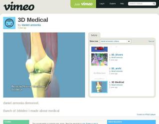 Demo 3D de diverses réalisations pour le médical